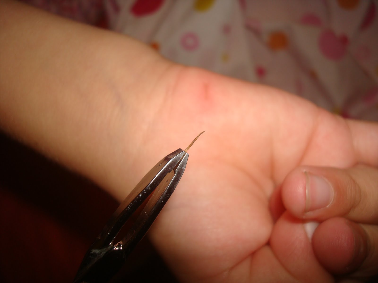 Splinter Prevention Guide for Parents