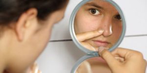 Surprising Tips That Actually Avoid Acne From Spreading